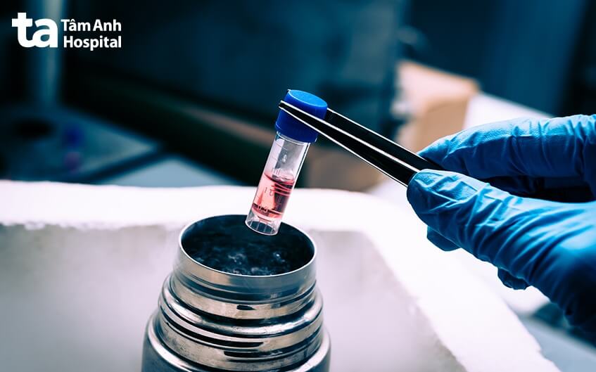 ứng dụng tế bào gốc trong điều trị tự kỷ