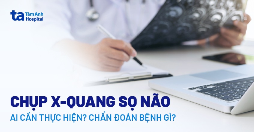 x quang sọ não