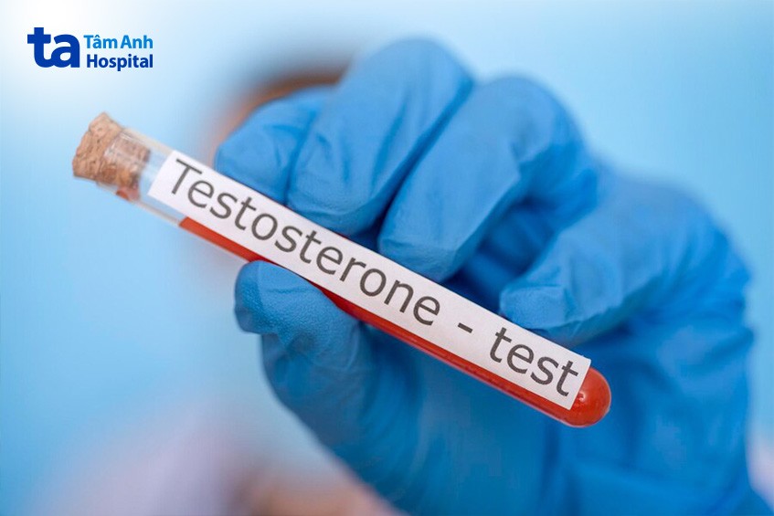 Xét nghiệm định lượng testosterone trong máu là phương pháp chẩn đoán tình trạng suy sinh dục hiệu quả.