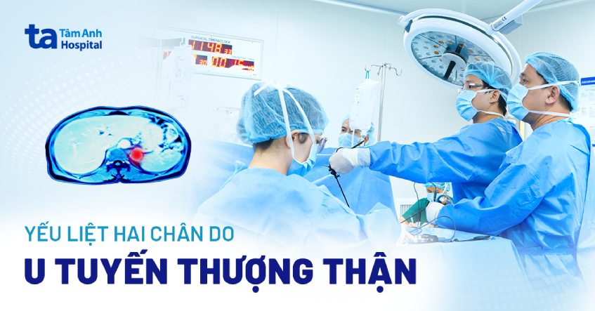 Yếu liệt tay chân do u tuyến thượng thận