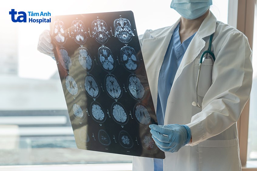Bác sĩ đánh giá mức độ nghiêm trọng của viêm màng não