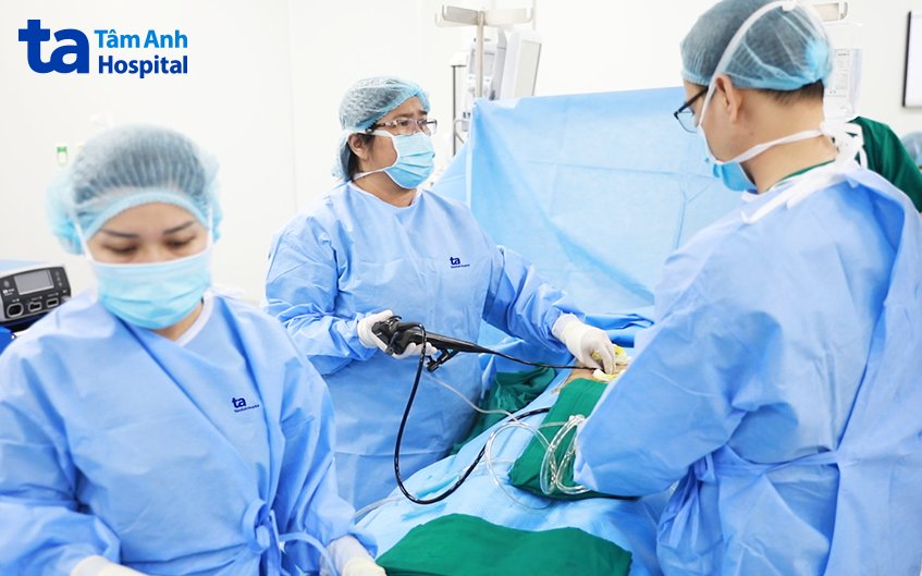 bác sĩ thực hiện tán sỏi đường mật