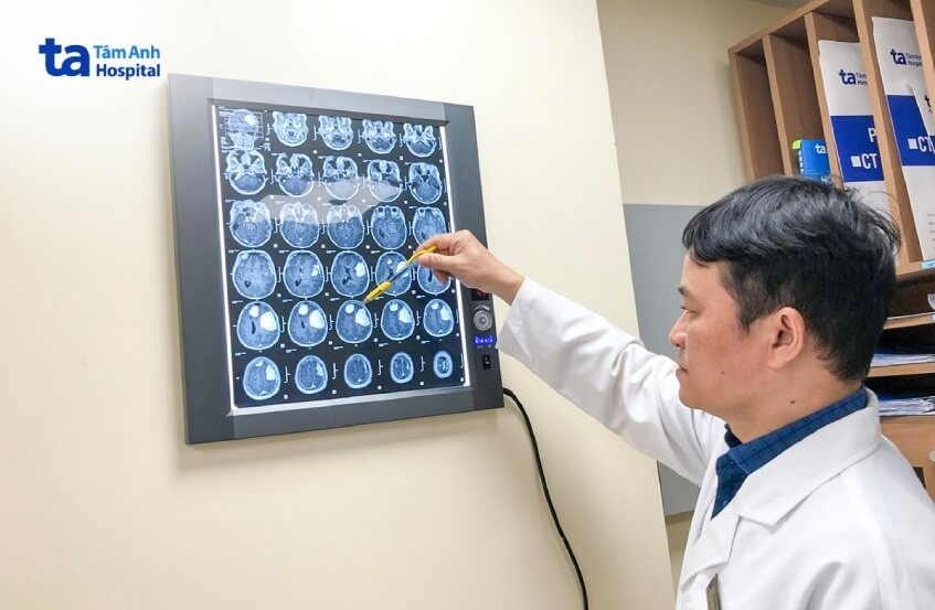 bác sĩ đánh giá hai khối u lớn