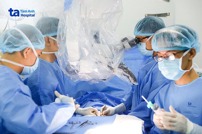 ca phẫu thuật trích tinh trùng