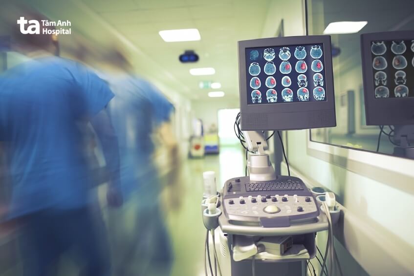 cấp cứu đột quỵ fast