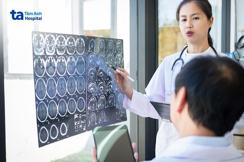 chẩn đoán áp xe não