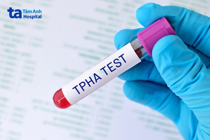 Xét nghiệm giang mai gặp nhiều khó khăn