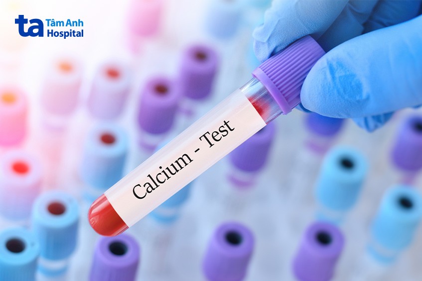 chẩn đoán hạ canxi máu