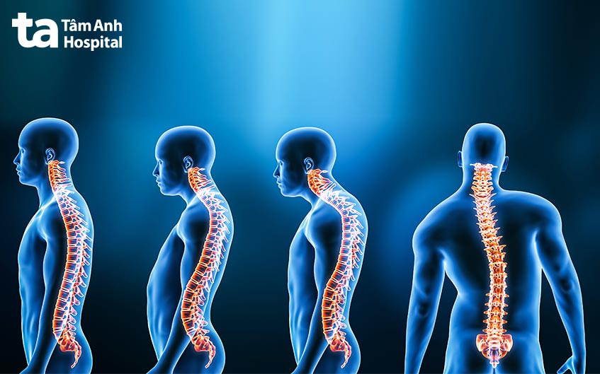 chỉ định can thiệp ngoại khoa đối với trường hợp nặng