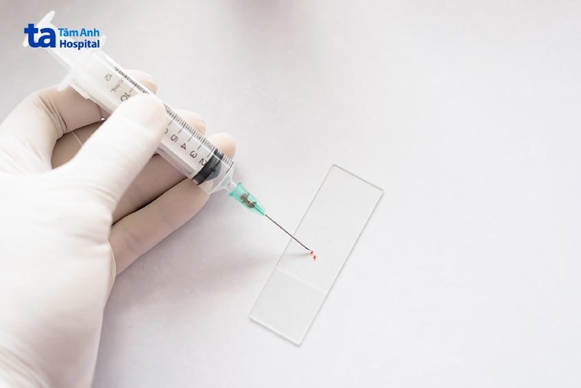 chọc sinh thiết hạch cổ