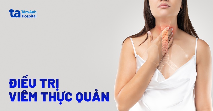 chữa viêm thực quản