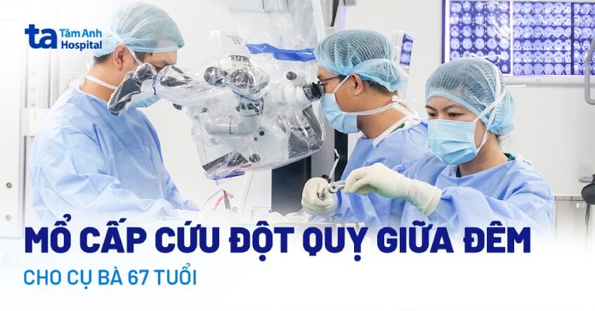 Cứu cụ bà bị đột quỵ nửa đêm do vỡ mạch máu não