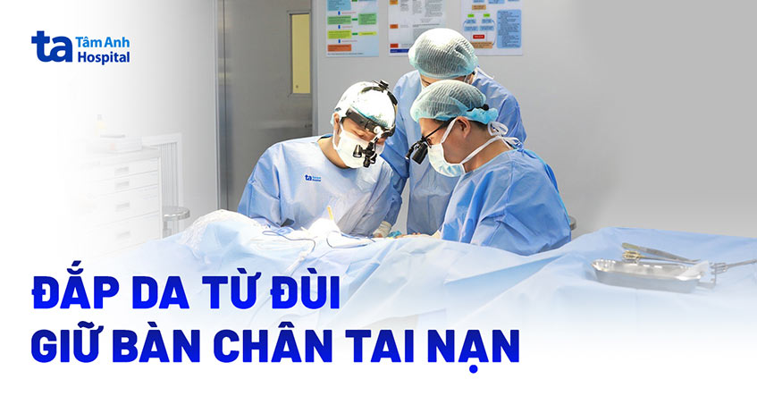 Đắp da từ đùi, giữ bàn chân tai nạn