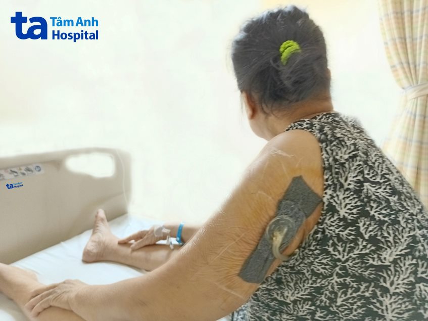 đặt máy hút áp lực âm