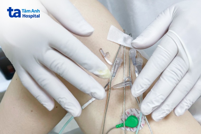 Điều dưỡng thực hiện đo niệu động học để khảo sát chức năng bàng quang cho người bệnh.