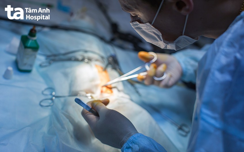 điều trị viêm ruột hoại tử