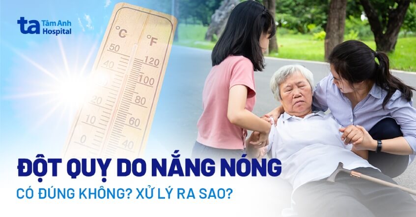 Đột quỵ do nắng nóng có đúng không? Nguyên nhân và cách xử trí