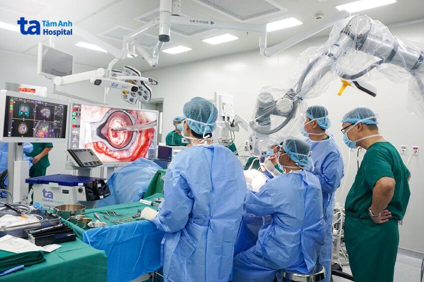ekip bac sĩ điều trị ca bệnh u não