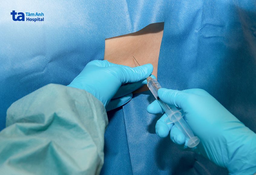 giá sinh thiết tủy xương