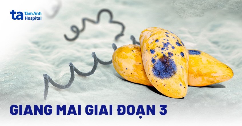 Giang mai giai đoạn 3 có chữa được không? Dấu hiệu và chẩn đoán
