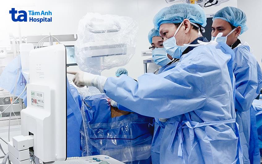 hệ thống máy C-arm với cánh tay X-quang