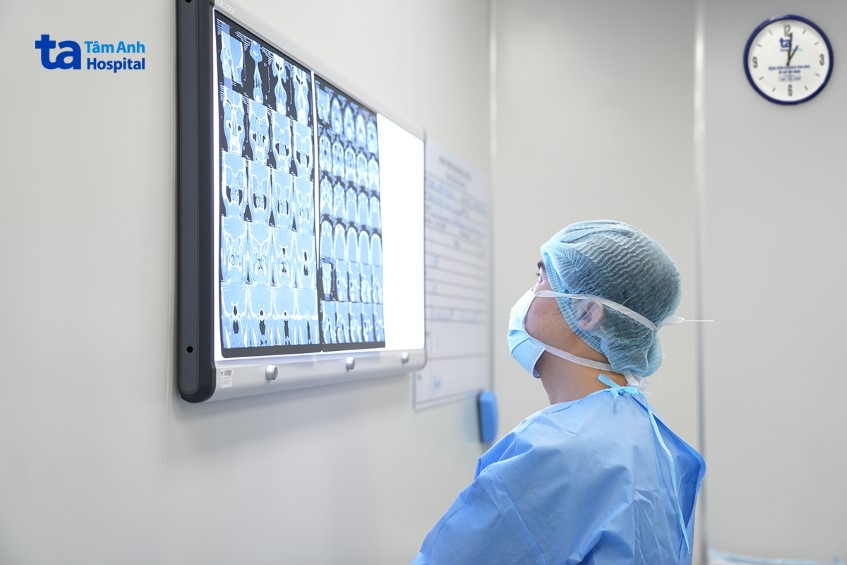 Kết quả CT của bệnh nhân