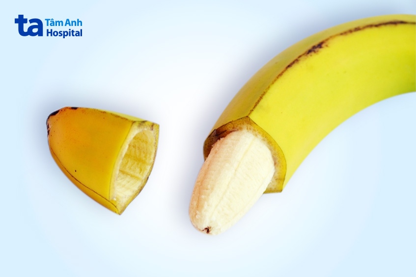 Cắt bao quy đầu được chỉ định để điều trị các vấn đề liên quan đến dương vật