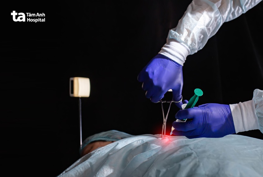 kỹ thuật sinh thiết hạch