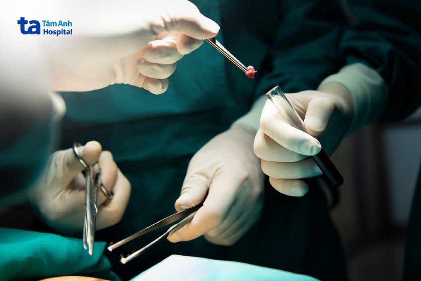 kỹ thuật sinh thiết lạnh