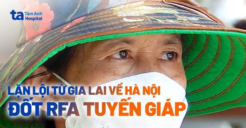 lặn lội từ gia lai về hà nội đốt rfa tuyến giáp