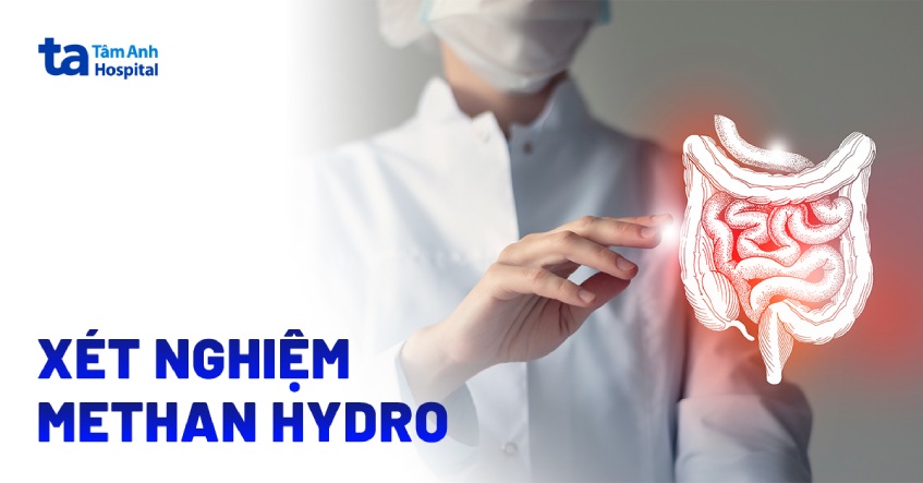 methan hydro xét nghiệm