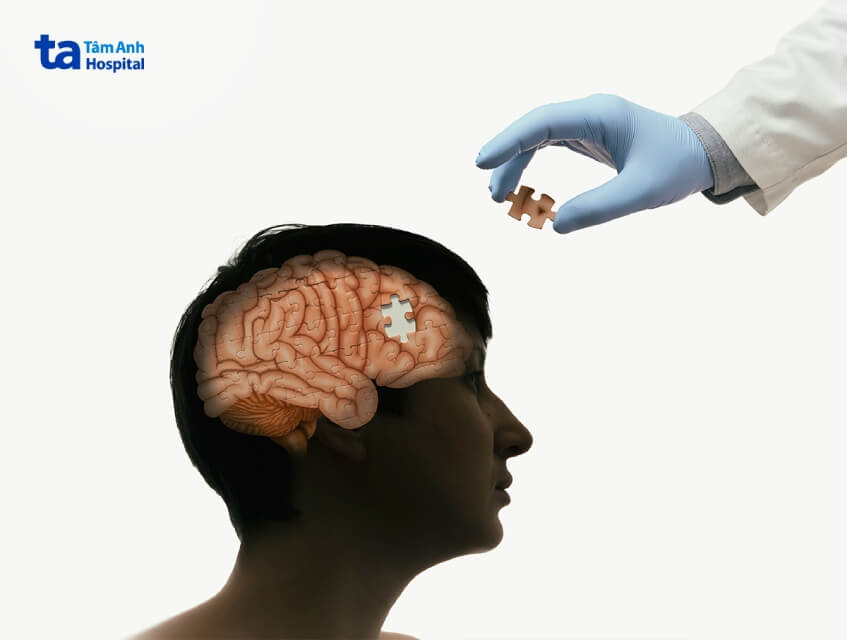 mổ ghép sọ có nguy hiểm không