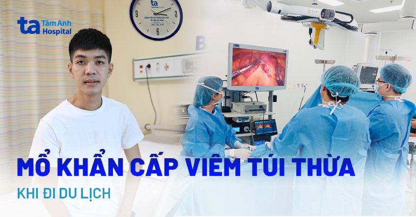Viêm túi thừa khi đi du lịch