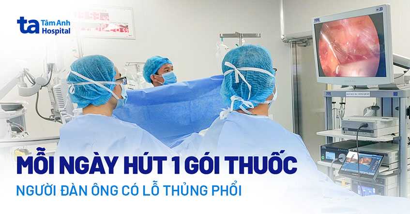 Mỗi ngày hút một gói thuốc người đàn ông có lổ thủng phổi