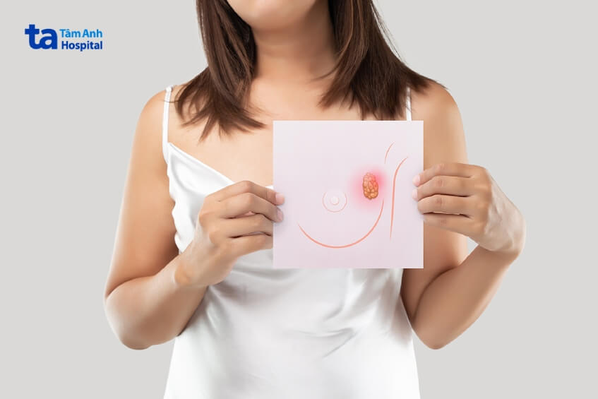 nguyên nhân u màng não lành tính