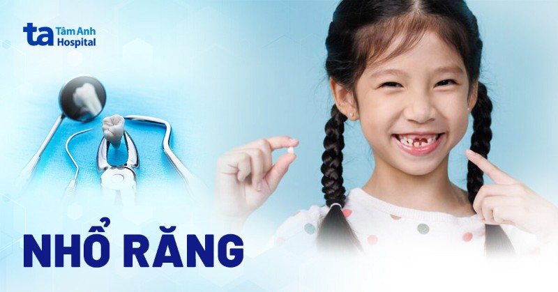 nhổ răng