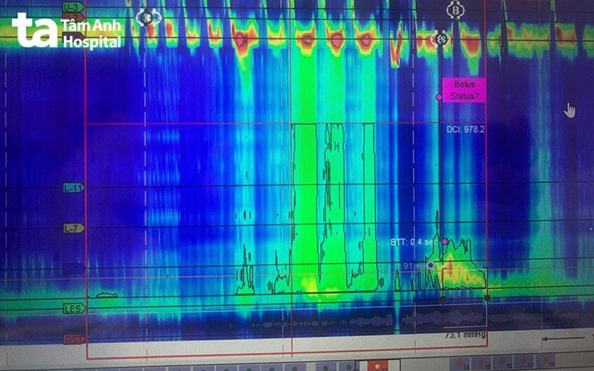 nhu động thực quản