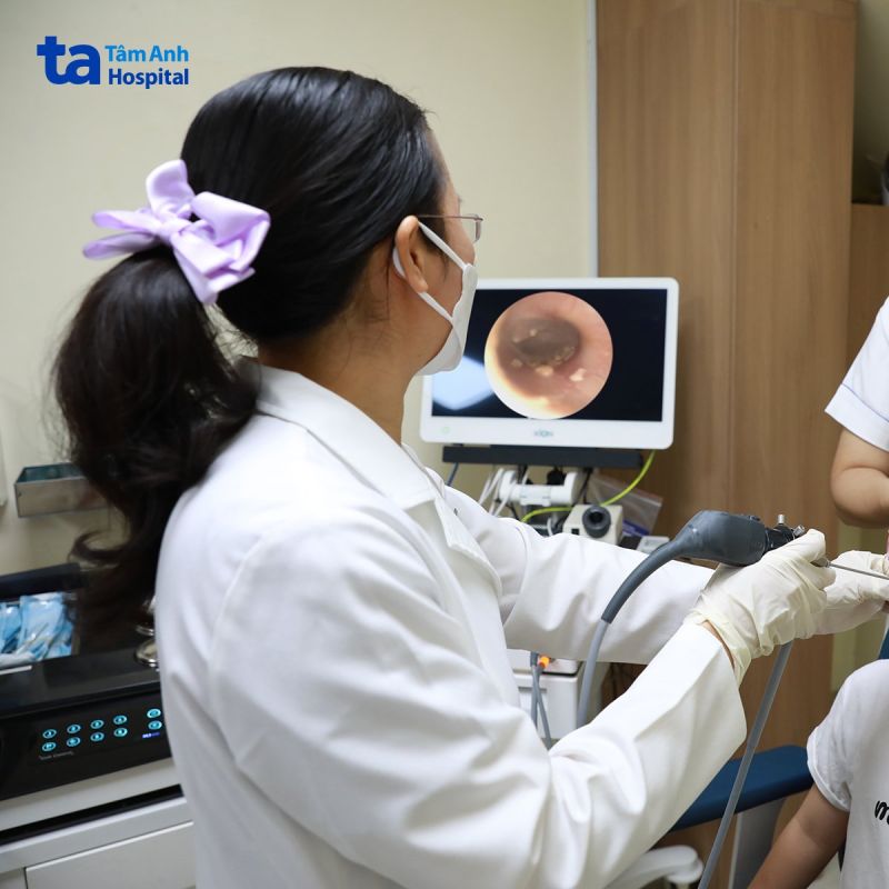 nội soi cát trong tai bé