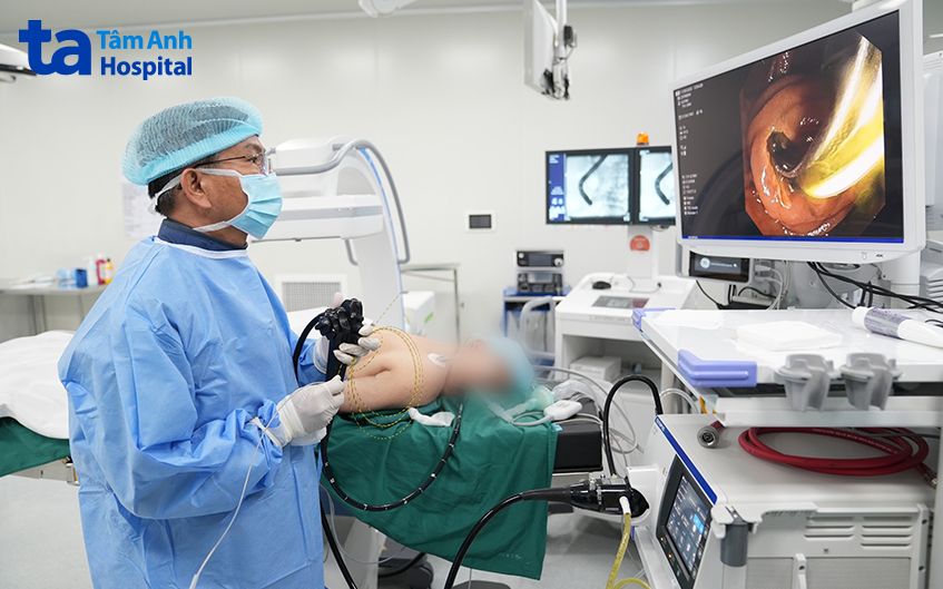 phẫu thuật nội soi đường tiêu hóa