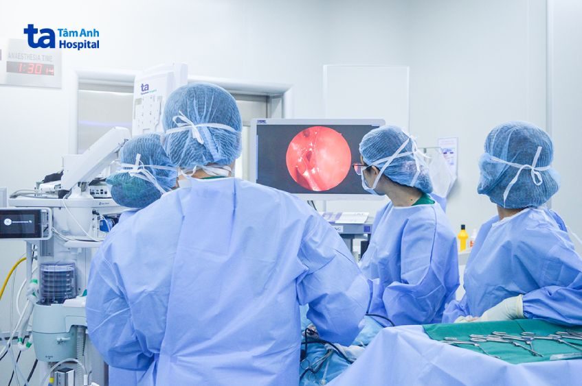 phẫu thuật nội soi xoang