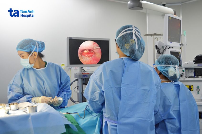 phẫu thuật tai nội soi