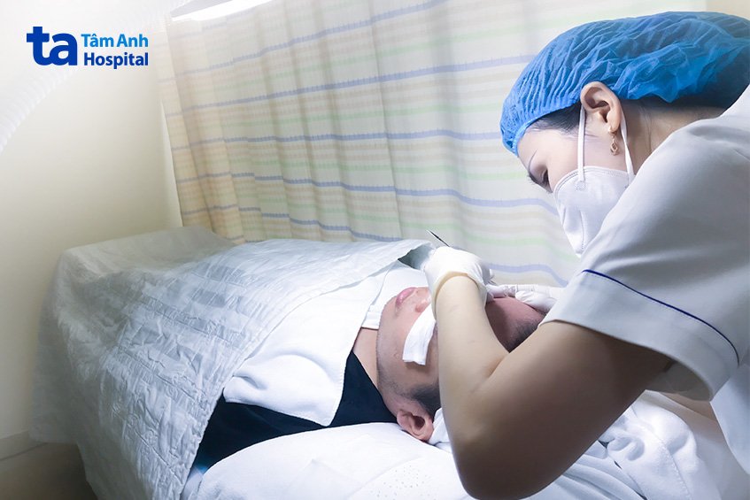 Mụn đầu đen nặn không đúng cách có thể để lại thâm sẹo nên được bác sĩ khám và điều trị.