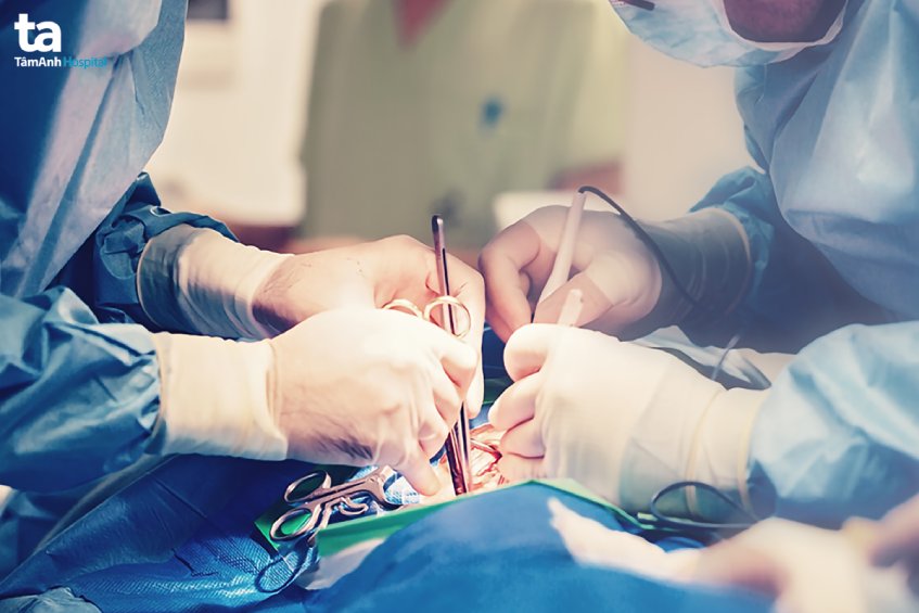 quy trình sinh thiết gan