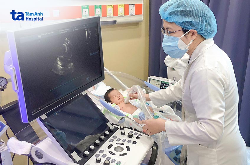 Siêu âm tim là một trong những phương pháp chẩn đoán tăng áp phổi ở trẻ sơ sinh