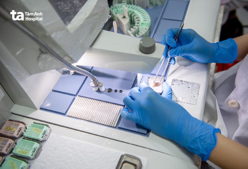 sinh thiết da bao lâu có kết quả