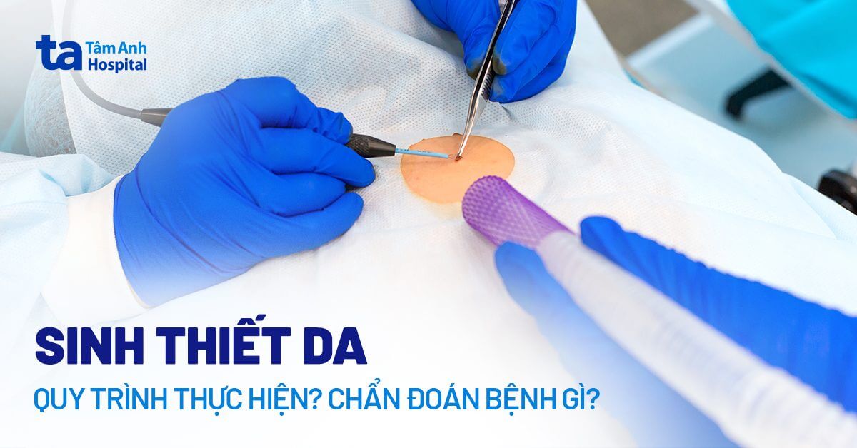 Sinh thiết da: Đối tượng và khi nào cần thực hiện? Quy trình ra sao?