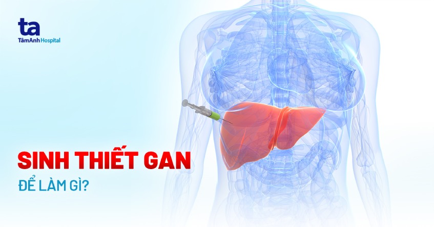 sinh thiết gan để làm gì