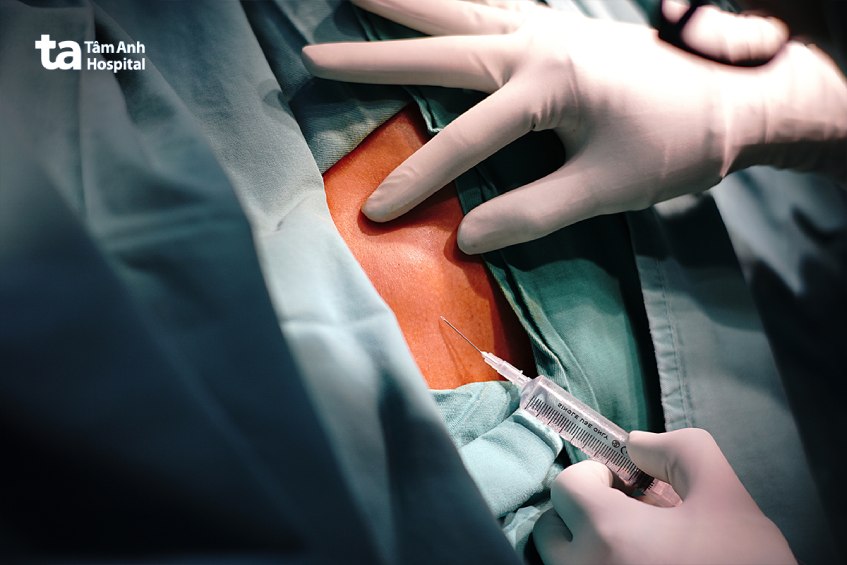 sinh thiết hạch có đau không