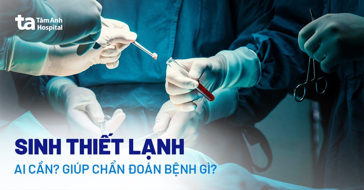 Sinh thiết lạnh (tức thì): Có chính xác không và quy trình ra sao?