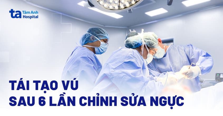 Tái tạo vú cho phụ nữ 6 lần chỉnh sửa ngực